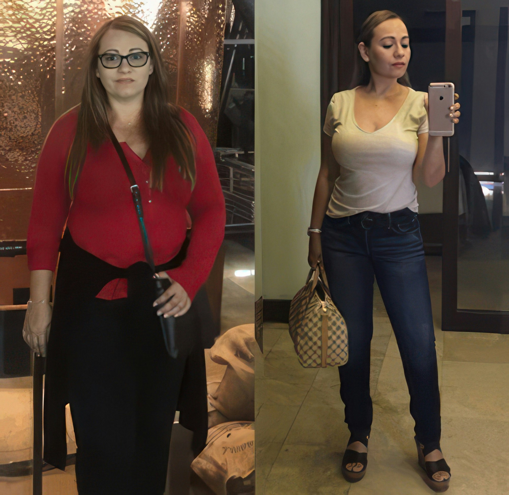 Edith before and after gastric sleeve surgery